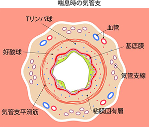 気管支喘息（ぜんそく）